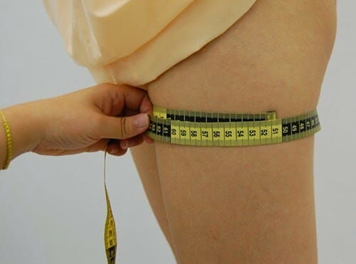 Before VelaShape treatment - Left thigh Before VelaShape treatment - Left thigh