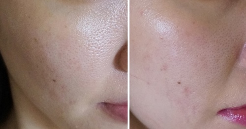 Oshan Infinite Before After | Glowing Radiant Skin with OSHAN INFINITE Collagen Drink OSHAN INFINITE - Before & After