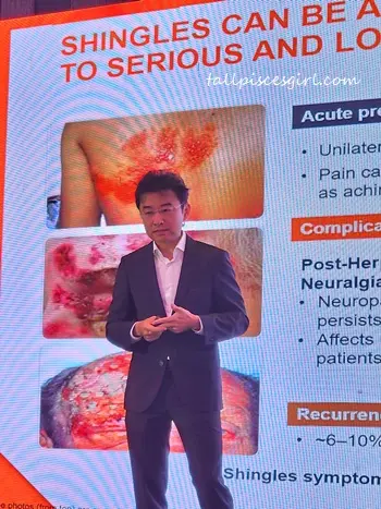 Dr. Peter Chng Consultant Dermatologist at Gleneagles Hospital Kuala Lumpur and Honorary Secretary of the Dermatological Society of Malaysia sharing on the burden of shingles | Shingrix: GSK Shingles Vaccine Now Available in Malaysia Dr. Peter Ch'ng, Consultant Dermatologist at Gleneagles Hospital Kuala Lumpur and Honorary Secretary of the Dermatological Society of Malaysia, sharing on the burden of shingles